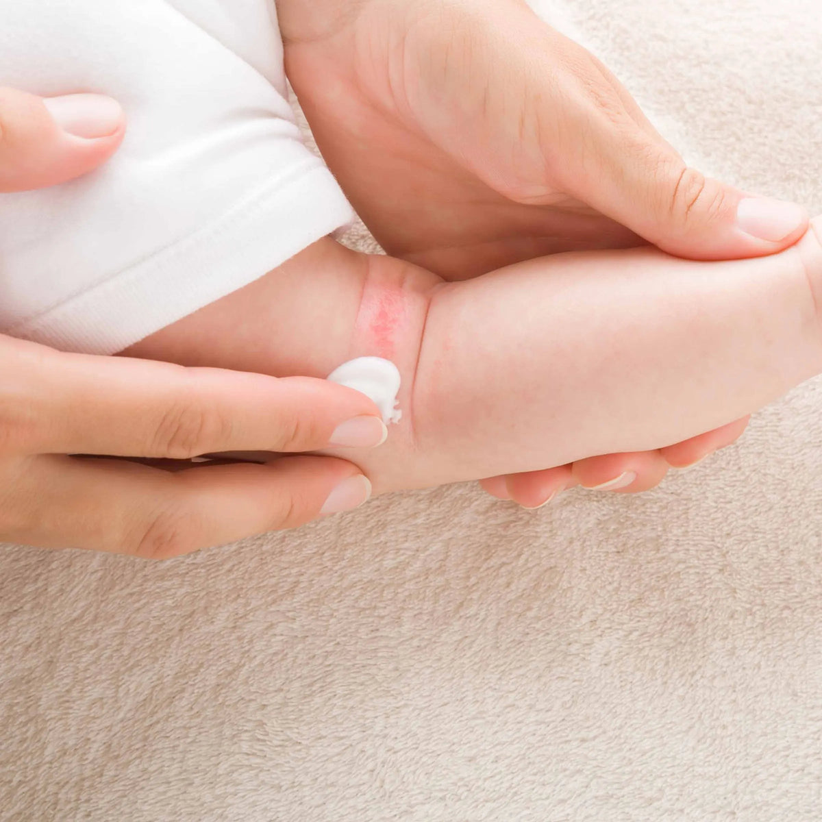 Wundschutzcreme von vujo wird beim Wickeln auf die Babyhaut aufgetragen